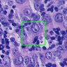 Histopathological Cancer Detection sample image